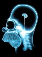 Radiografa de Homer Simpson con un cerebro del tamao de un cacahuete